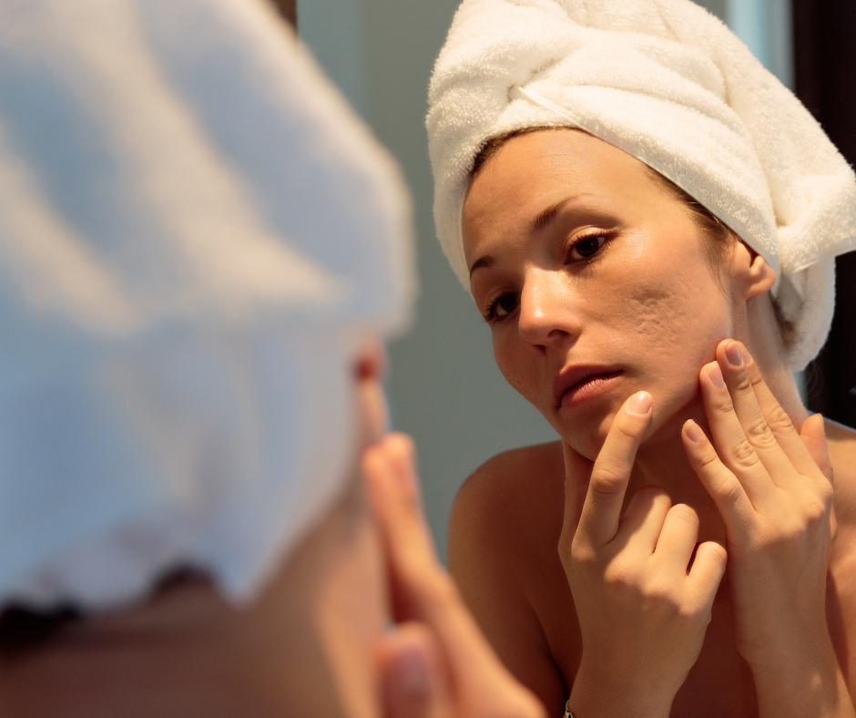 Facials safe for acne scars